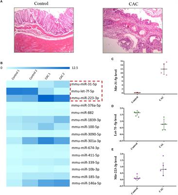 Post-transcriptional Gene Regulation in Colitis Associated Cancer